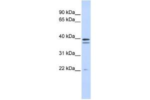 RABGGTB antibody used at 1 ug/ml to detect target protein. (RABGGTB Antikörper  (Middle Region))