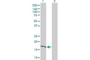 Western Blot analysis of TMEM54 expression in transfected 293T cell line by TMEM54 MaxPab polyclonal antibody. (TMEM54 Antikörper  (AA 1-169))