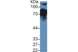 Detection of CFH in Mouse Serum using Polyclonal Antibody to Complement Factor H (CFH)
