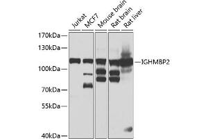 Western blot analysis of extracts of various cell lines, using IGHMBP2 antibody (ABIN6129602, ABIN6142269, ABIN6142270 and ABIN6223077) at 1:1000 dilution. (IGHMBP2 Antikörper)