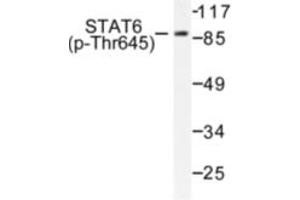 Image no. 1 for anti-Signal Transducer and Activator of Transcription 6, Interleukin-4 Induced (STAT6) (pThr645) antibody (ABIN318132) (STAT6 Antikörper  (pThr645))