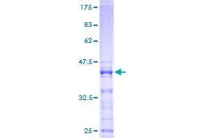 Image no. 1 for Ribosomal Protein S25 (RPS25) (AA 1-125) protein (GST tag) (ABIN1318780) (RPS25 Protein (AA 1-125) (GST tag))