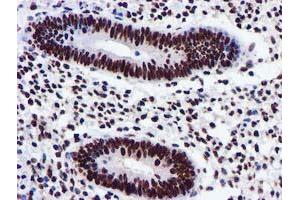 Image no. 4 for anti-Glutathione S-Transferase theta 2 (GSTT2) antibody (ABIN1498553) (GSTT2 Antikörper)