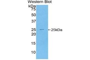 Western blot analysis of the recombinant protein. (TICAM2 Antikörper  (AA 34-241))