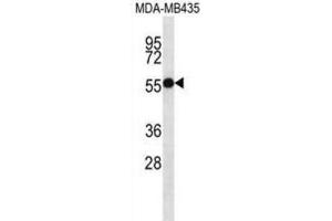 Western Blotting (WB) image for anti-Ankyrin Repeat and SOCS Box Containing 4 (ASB4) antibody (ABIN2997237) (ASB4 Antikörper)