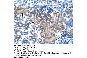 Human kidney (FAM164A Antikörper  (C-Term))