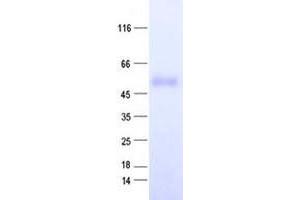 ZNF566 Protein (His tag)