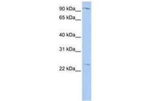 Image no. 1 for anti-Oxysterol Binding Protein-Like 8 (OSBPL8) (N-Term) antibody (ABIN6740875) (OSBPL8 Antikörper  (N-Term))