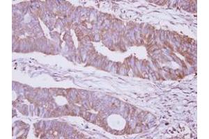Image no. 1 for anti-Mannosidase, Alpha, Class 2B, Member 2 (MAN2B2) (N-Term) antibody (ABIN1494047) (MAN2B2 Antikörper  (N-Term))