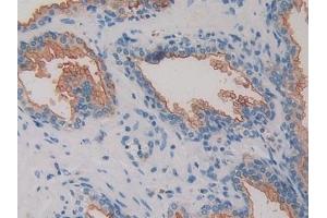 Immunohistochemistry (IHC) image for anti-Dipeptidyl-Peptidase 4 (DPP4) (AA 484-728) antibody (ABIN7432829)
