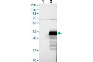 Western blot analysis of Lane 1: Negative control (vector only transfected HEK293T lysate), Lane 2: Over-expression Lysate (Co-expressed with a C-terminal myc-DDK tag (~3. (ZCCHC24 Antikörper)