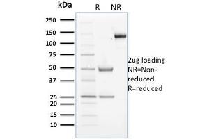 SDS-PAGE Analysis Purified Cyclin B2 Mouse Monoclonal Antibody (X29. (Cyclin B2 Antikörper)