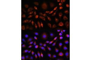 Immunofluorescence analysis of L929 cells using ApoM Rabbit pAb (ABIN6127365, ABIN6137030, ABIN6137031 and ABIN6220968) at dilution of 1:100. (Apolipoprotein M Antikörper  (AA 23-188))