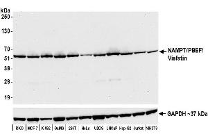 Western Blotting (WB) image for anti-Nicotinamide phosphoribosyltransferase (NAMPT) (AA 400-450) antibody (ABIN7454014)