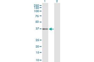 Western Blotting (WB) image for anti-DNA Fragmentation Factor, 40kDa, beta Polypeptide (Caspase-Activated DNase) (DFFB) (AA 1-338) antibody (ABIN514957)
