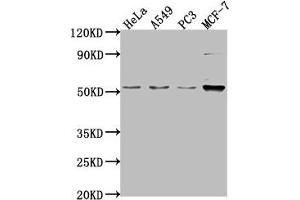Western Blot Positive WB detected in: Hela whole cell lysate, A549 whole cell lysate, PC-3 whole cell lysate, MCF-7 whole cell lysate All lanes: FKTN antibody at 1:2000 Secondary Goat polyclonal to rabbit IgG at 1/50000 dilution Predicted band size: 54, 50 kDa Observed band size: 54 kDa (Fukutin Antikörper  (AA 87-276))