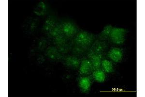 Immunofluorescence of monoclonal antibody to S100A7 on A-431 cell. (S100A7 Antikörper  (AA 1-101))