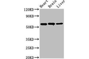 Western Blot Positive WB detected in: Rat heart tissue, Rat brain tissue, Mouse liver tissue All lanes: ALDH5A1 antibody at 3. (ALDH5A1 Antikörper  (AA 48-535))