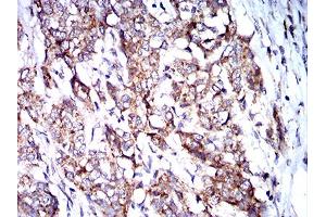 Immunohistochemistry (IHC) image for anti-BCL2/adenovirus E1B 19kDa Interacting Protein 3 (BNIP3) (AA 50-155) antibody (ABIN5858883) (BNIP3 Antikörper  (AA 50-155))