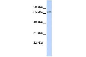 WB Suggested Anti-TRIM41 Antibody Titration:  0. (TRIM41 Antikörper  (C-Term))