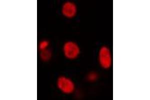 ABIN6274439 staining HuvEc cells by IF/ICC. (SMARCC2 Antikörper  (Internal Region))
