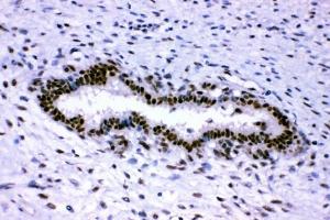 IHC analysis of p95 NBS1 using anti-p95 NBS1 antibody (ABIN3043282). (Nibrin Antikörper  (C-Term))