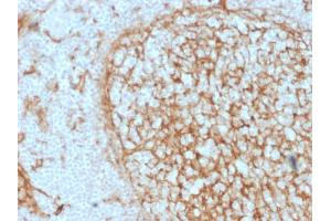 Immunohistochemistry (IHC) image for anti-CD14 (CD14) (AA 25-148) antibody (ABIN6941095)