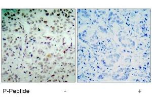 Image no. 1 for anti-Retinoblastoma 1 (RB1) (pSer780) antibody (ABIN196843) (Retinoblastoma 1 Antikörper  (pSer780))