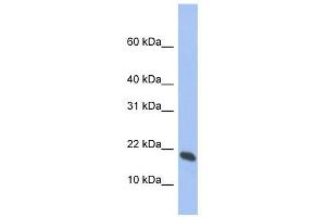 GMF gamma antibody used at 1 ug/ml to detect target protein. (GMFG Antikörper  (Middle Region))