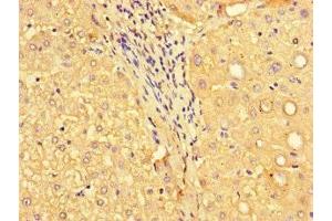 Immunohistochemistry of paraffin-embedded human liver tissue using ABIN7160576 at dilution of 1:100 (MYH3 Antikörper  (AA 1-217))