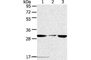 Western blot analysis of PC3 and hepg2 cell, human fetal liver tissue, using SDHB Polyclonal Antibody at dilution of 1:400 (SDHB Antikörper)
