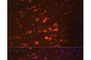 Immunofluorescence analysis of Mouse brain using NEFM Polyclonal Antibody at dilution of 1:100. (NEFM Antikörper)