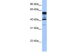 WB Suggested Anti-FAM46C Antibody Titration: 0. (FAM46C Antikörper  (Middle Region))