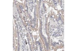 Immunohistochemical staining of human duodenum with NT5DC1 polyclonal antibody  shows moderate cytoplasmic positivity in glandular cells. (NT5DC1 Antikörper)