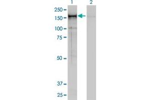 Western Blotting (WB) image for anti-Non-SMC Condensin I Complex, Subunit D2 (NCAPD2) (AA 1240-1339) antibody (ABIN599100) (NCAPD2 Antikörper  (AA 1240-1339))