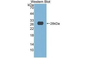 Detection of Recombinant DNASE1, Human using Monoclonal Antibody to Deoxyribonuclease I (DNASE1) (DNASE1 Antikörper  (AA 19-259))