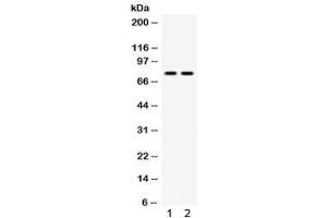 Western blot testing of 1) mouse testis and 2) human 22RV1 lysate with MDM4 antibody.
