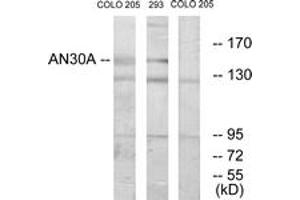 Western blot analysis of extracts from 293/COLO cells, using AN30A Antibody. (ANKRD30A Antikörper  (AA 1041-1090))
