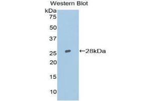 Western Blotting (WB) image for anti-Topoisomerase (DNA) II beta 180kDa (TOP2B) (AA 446-655) antibody (ABIN1860831) (TOP2B Antikörper  (AA 446-655))