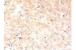 IHC-P analysis of Human Prostate Gland Tissue, with DAB staining. (IL-13 Antikörper  (AA 25-146))