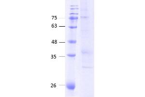 CCR5 Protein (AA 1-352) (Strep Tag)