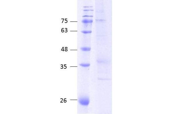 CCR5 Protein (AA 1-352) (Strep Tag)