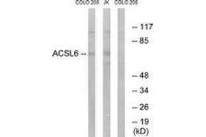 Western blot analysis of extracts from COLO/Jurkat cells, using ACSL6 Antibody. (ACSL6 Antikörper  (AA 499-548))