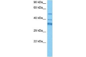 Host:  Mouse  Target Name:  GTF2H4  Sample Tissue:  Mouse Heart  Antibody Dilution:  1ug/ml (GTF2H4 Antikörper  (N-Term))