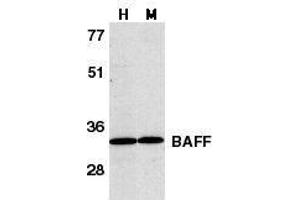 Western blot analysis of BAFF in human HL60 cell lysate (H) and murine spleen tissue lysate (M) with BAFF antibody at 1μg/ml. (BAFF Antikörper  (C-Term))