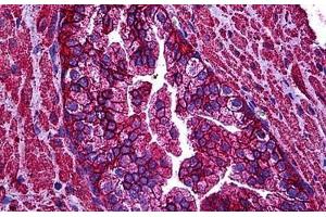 Human Prostate: Formalin-Fixed, Paraffin-Embedded (FFPE) (ABCC4 Antikörper  (AA 1-110))