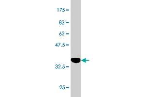 Western Blot detection against Immunogen (37. (Retinoic Acid Receptor alpha Antikörper  (AA 315-424))