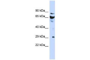 DCUN1D3 antibody used at 1 ug/ml to detect target protein.