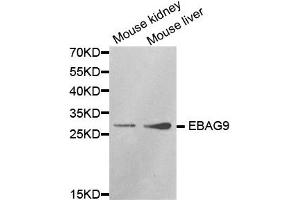 Western Blotting (WB) image for anti-Estrogen Receptor Binding Site Associated, Antigen, 9 (EBAG9) antibody (ABIN1872406)