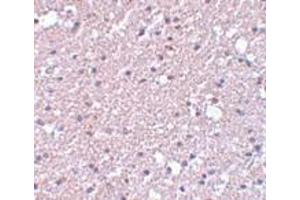 Immunohistochemistry (IHC) image for anti-Transmembrane Protein 184A (TMEM184A) (C-Term) antibody (ABIN1030750) (TMEM184A Antikörper  (C-Term))